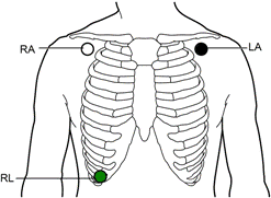 Posición electrodos Primera Derivación Distribuir contenido